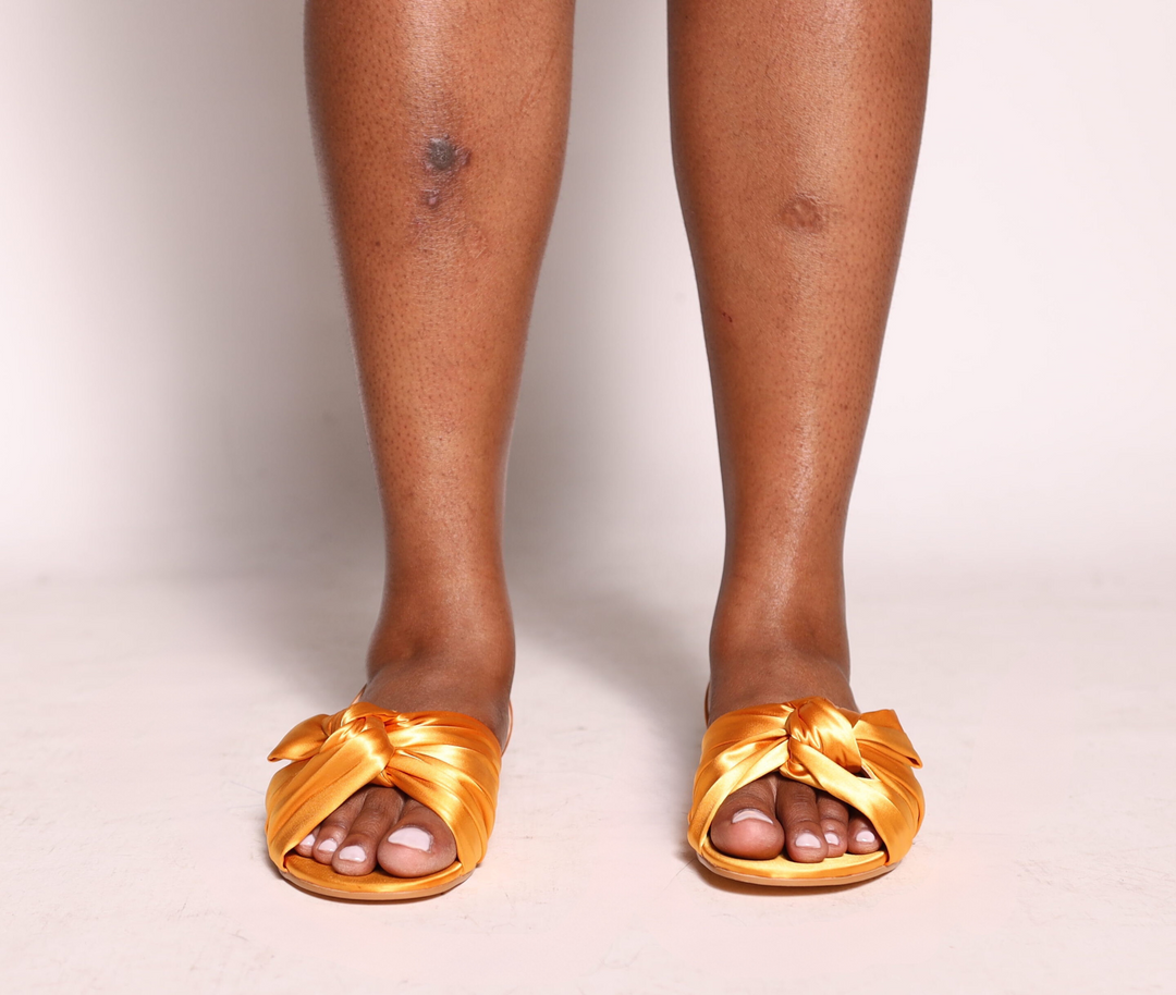 Lila Sandals - Marigold